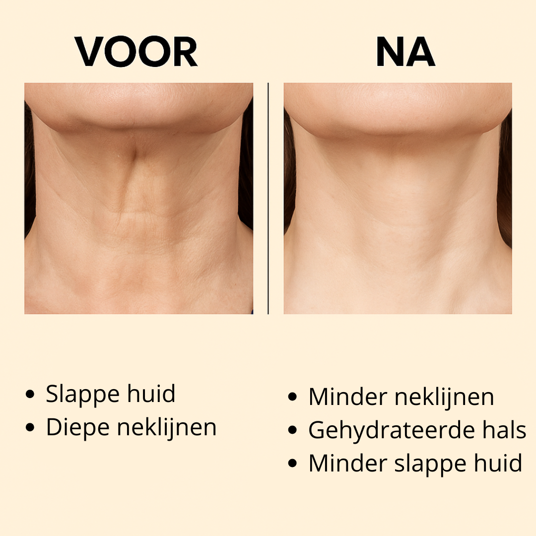 NeckLuxe™ | Bestrijd de tekenen van huidveroudering!
